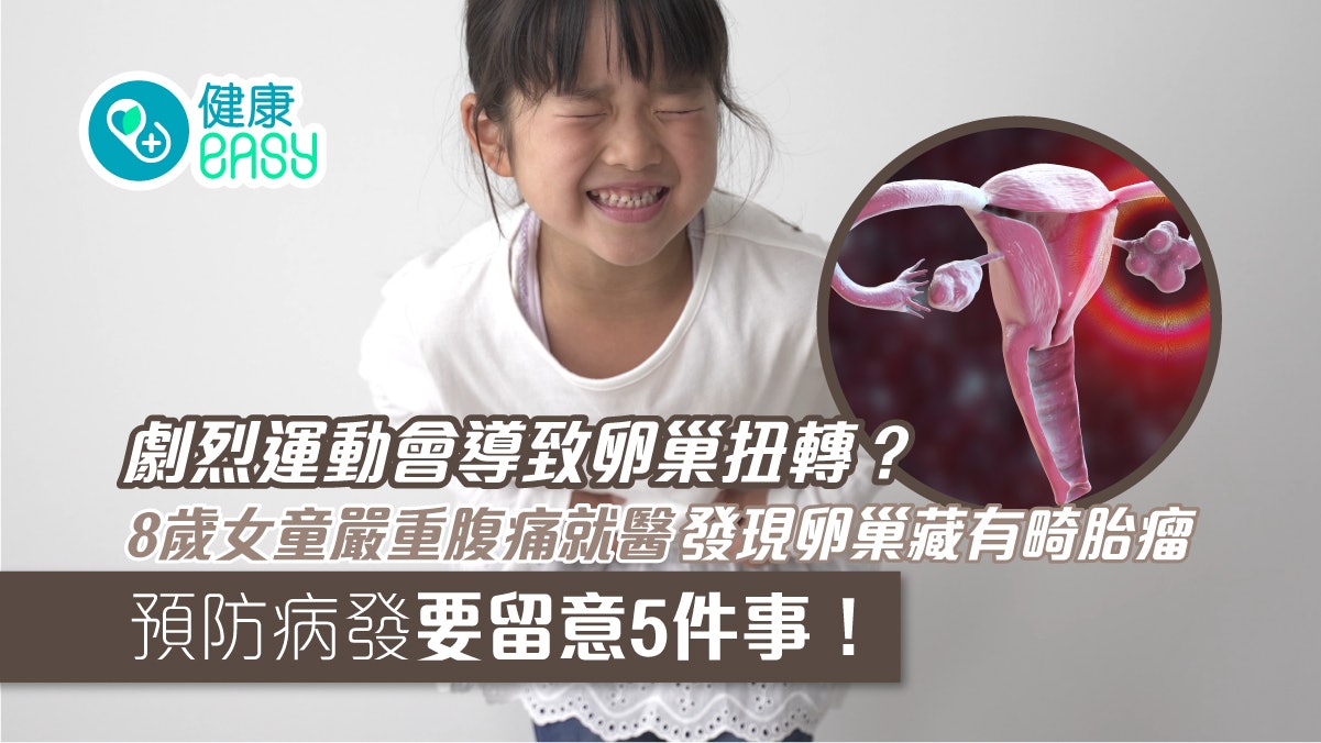 卵巢扭轉|8歲女童運動後突腹痛、嘔吐 就醫揭卵巢扭轉720度 卵巢扭轉|8歲女童運動後突腹痛、嘔吐 就醫揭卵巢扭轉720度