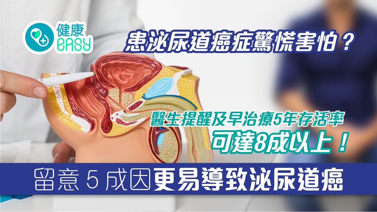 膀胱癌|罹泌尿道癌症莫驚慌!早期發現治療5年存活率可達8成以上 膀胱癌|罹泌尿道癌症莫驚慌!早期發現治療5年存活率可達8成以上