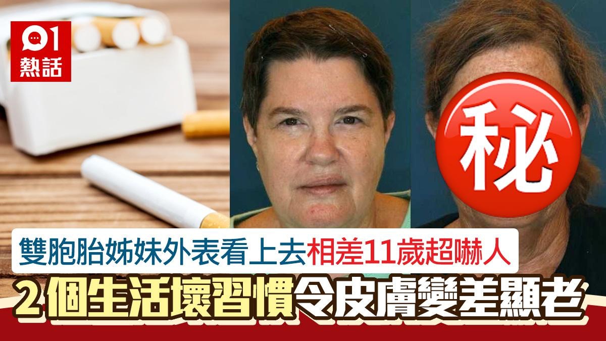 驚！雙胞胎姊妹看上去相差11歲照片瘋傳　３個因素影響外觀更顯老