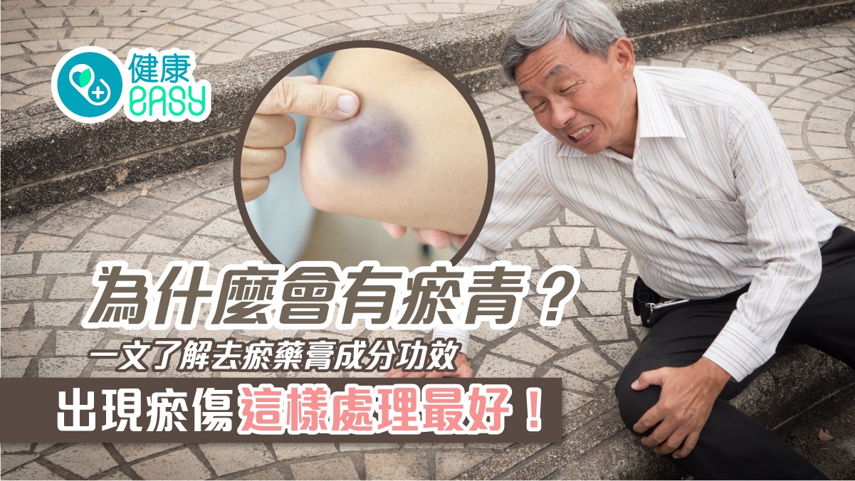 瘀青|為什麼出現瘀青?到底冰敷還是熱敷紓緩?第一時間要這樣做 瘀青|為什麼出現瘀青?到底冰敷還是熱敷紓緩?第一時間要這樣做