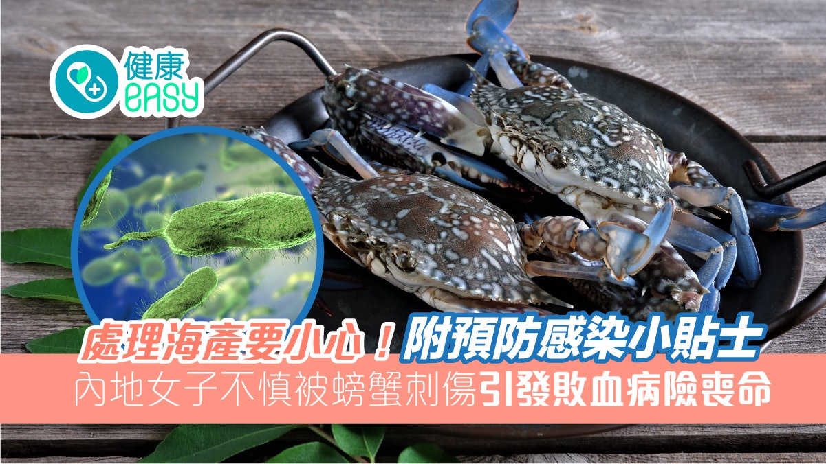 細菌感染|女子被螃蟹刺傷手掌發燒39℃休克 引發敗血病險喪命 細菌感染|女子被螃蟹刺傷手掌發燒39℃休克 引發敗血病險喪命