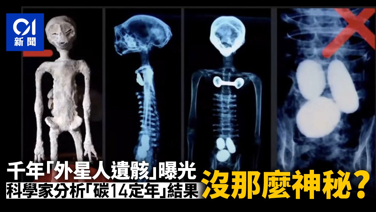 墨西哥曝光外星人遺骸秘魯質疑來歷科學家分析又來摑一巴？