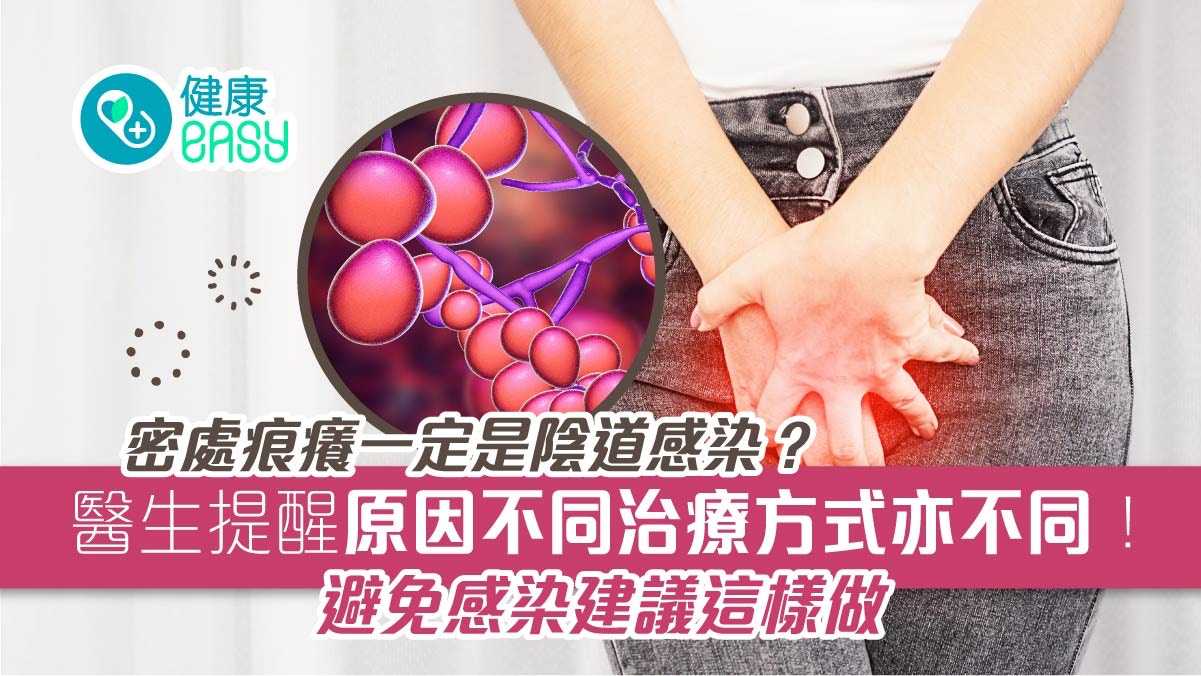 女性健康｜私密處痕癢原因大不同　清潔內褲3大重點避免陰道感染