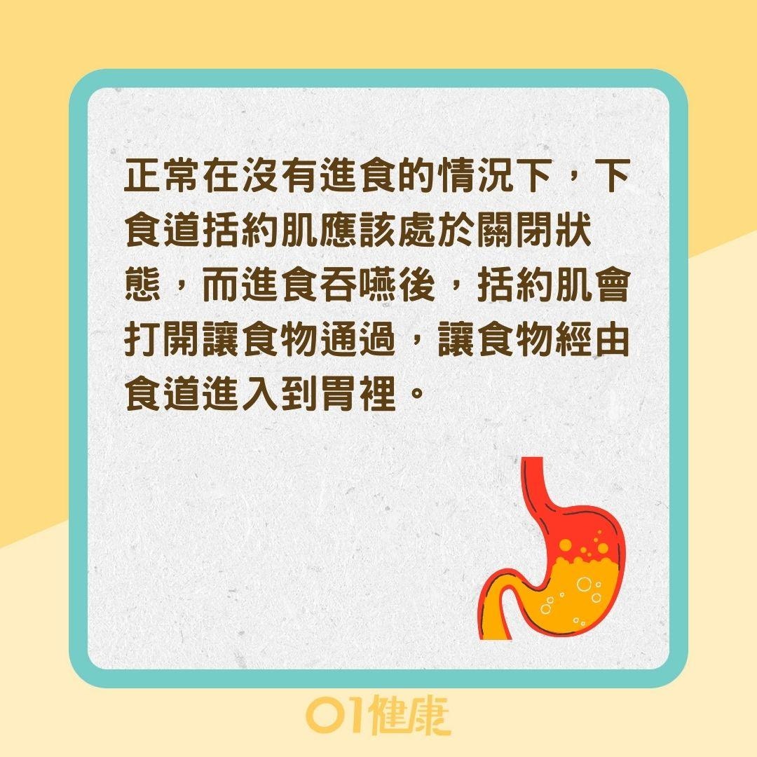 為什麼胃酸會逆流？（01製圖）