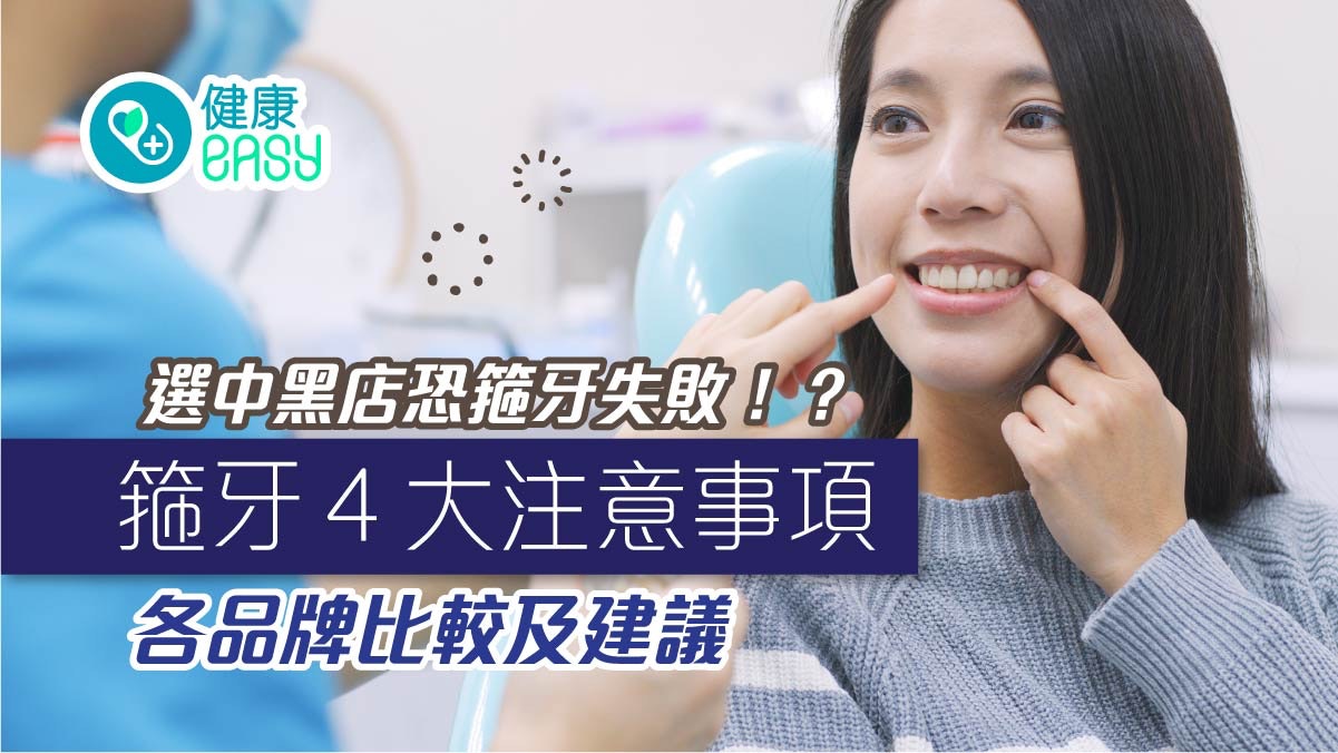 選中黑店恐箍牙失敗?箍牙4大注意事項 各品牌比較及建議 選中黑店恐箍牙失敗?箍牙4大注意事項 各品牌比較及建議