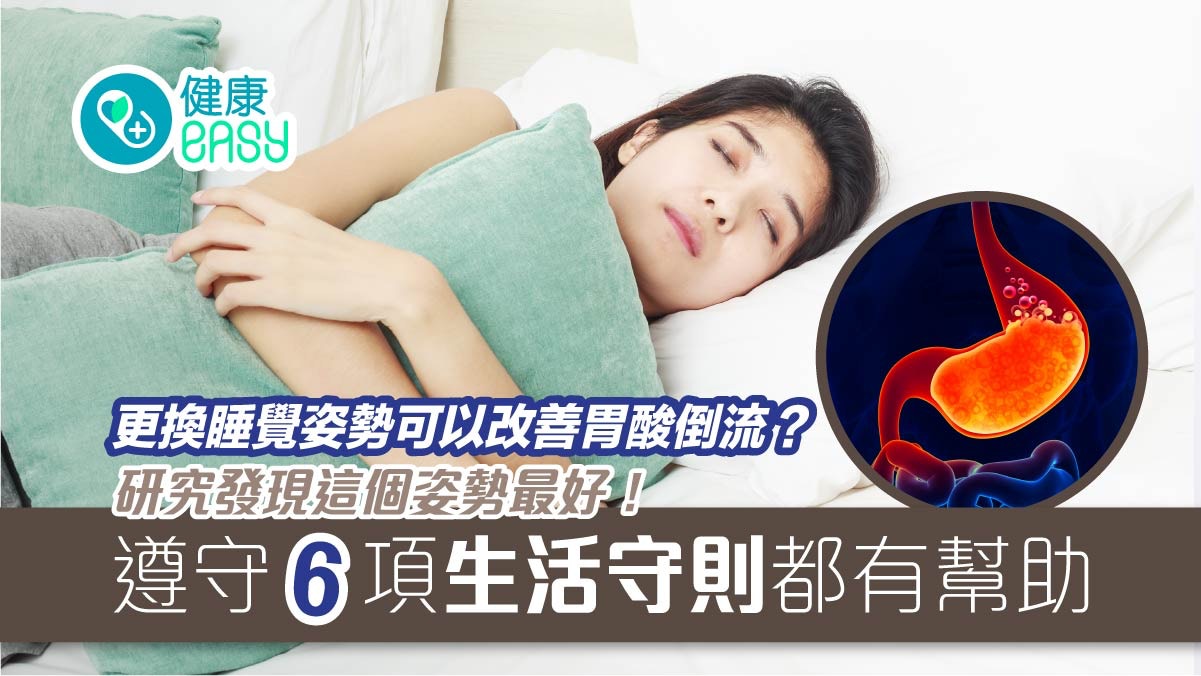 護胃｜左側臥睡姿可改善胃酸倒流？6項生活守則減少胃酸逆流發生