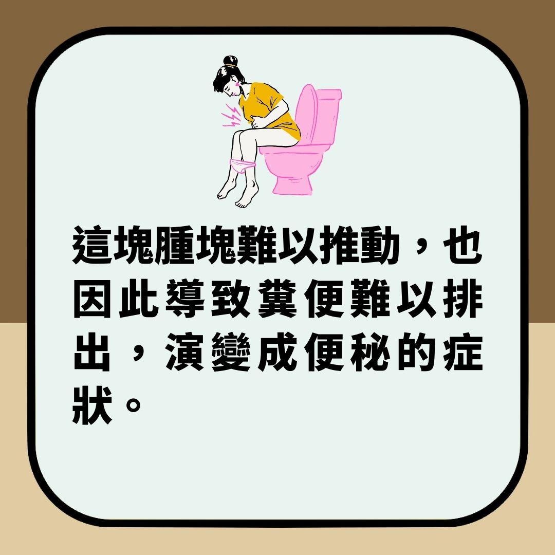 湖北女便秘10年「排便大噴血」終去醫院　檢查驚悉病因竟不在腸胃（01製圖）