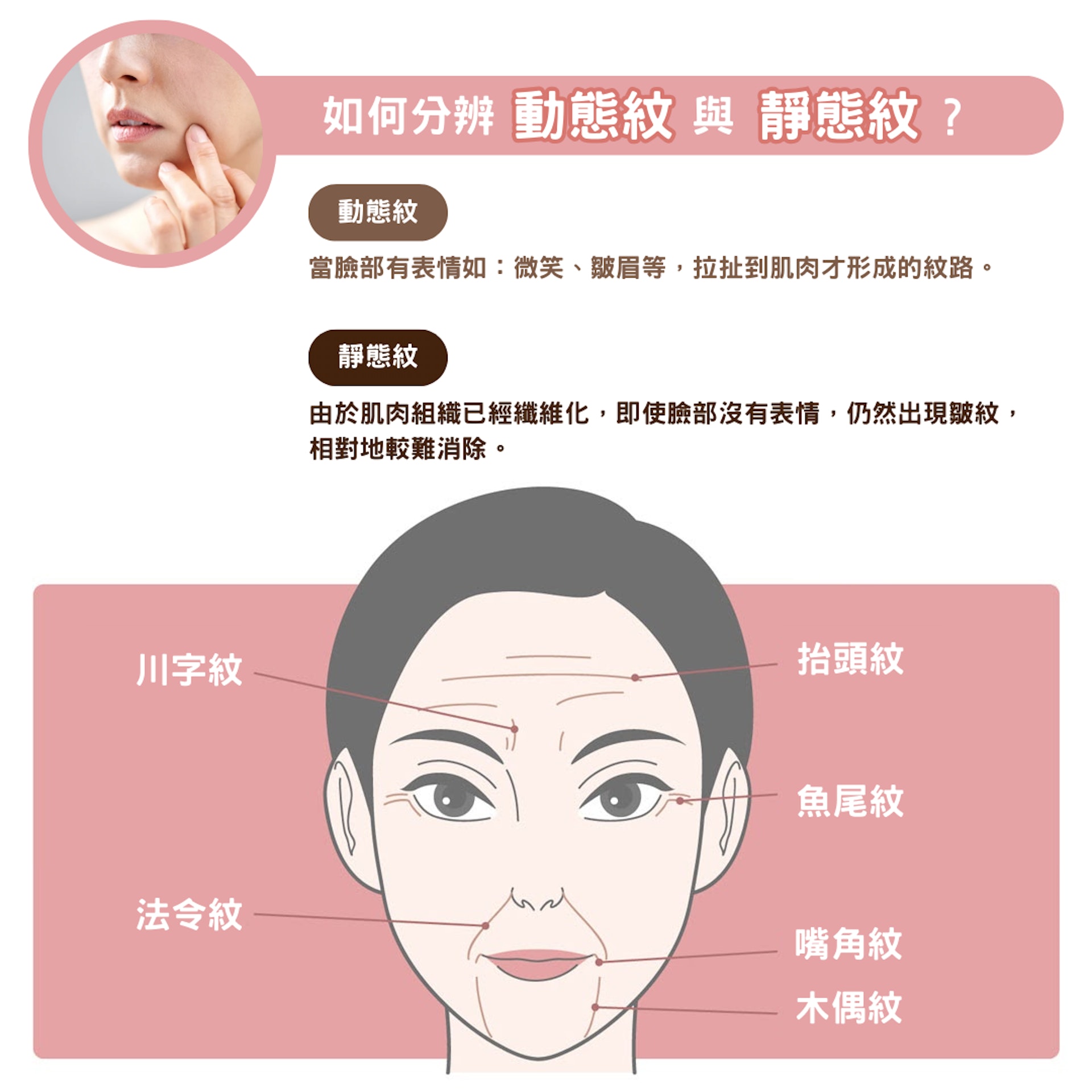 (圖片:醫美Easy) (圖片:醫美Easy)