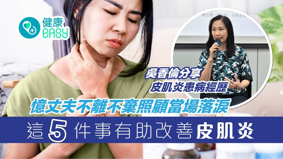 皮肌炎|吳香倫分享皮肌炎患病經歷 憶丈夫不離不棄照顧當場落淚 皮肌炎|吳香倫分享皮肌炎患病經歷 憶丈夫不離不棄照顧當場落淚