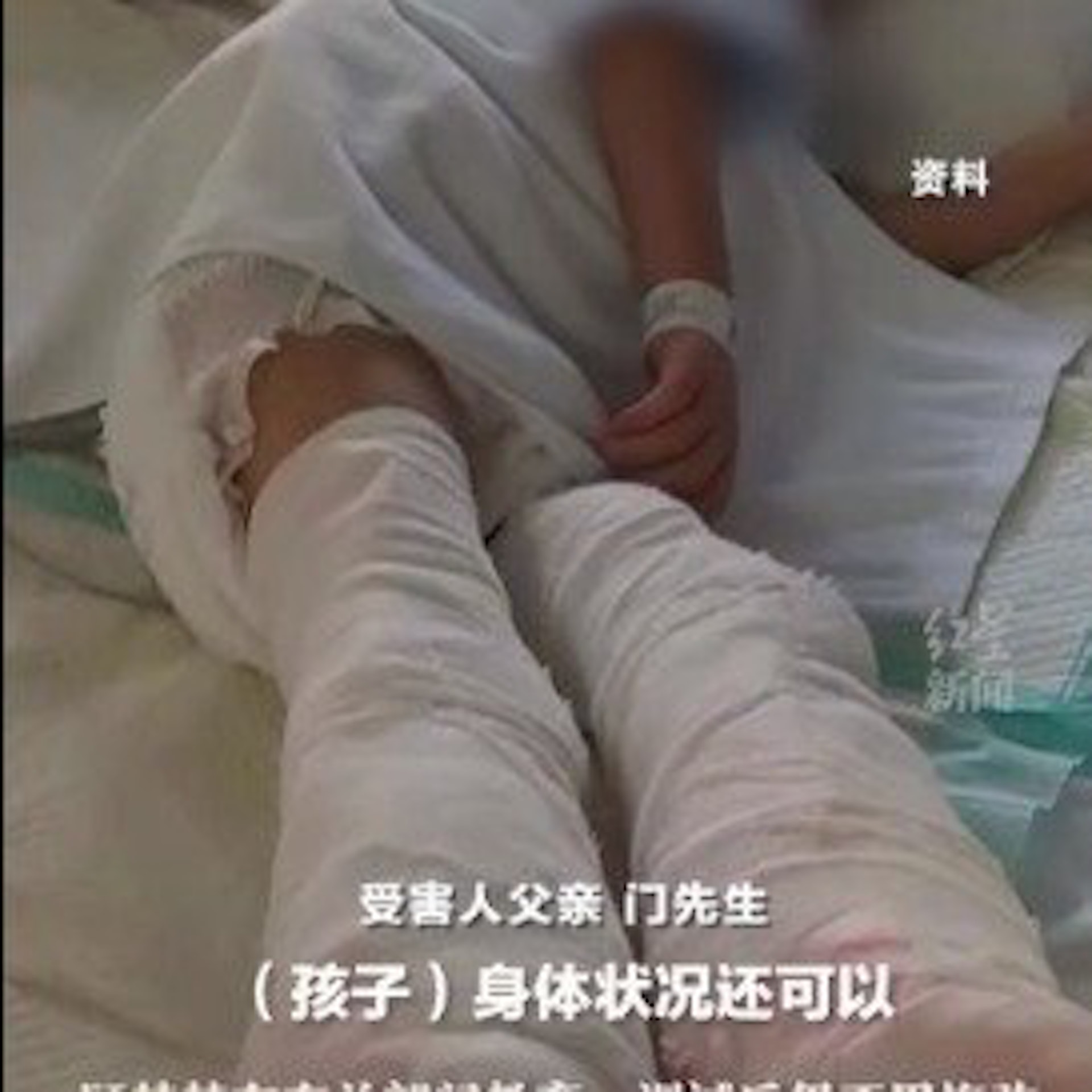 虐待5岁儿子致双腿截肢案:生母获刑6年9个月