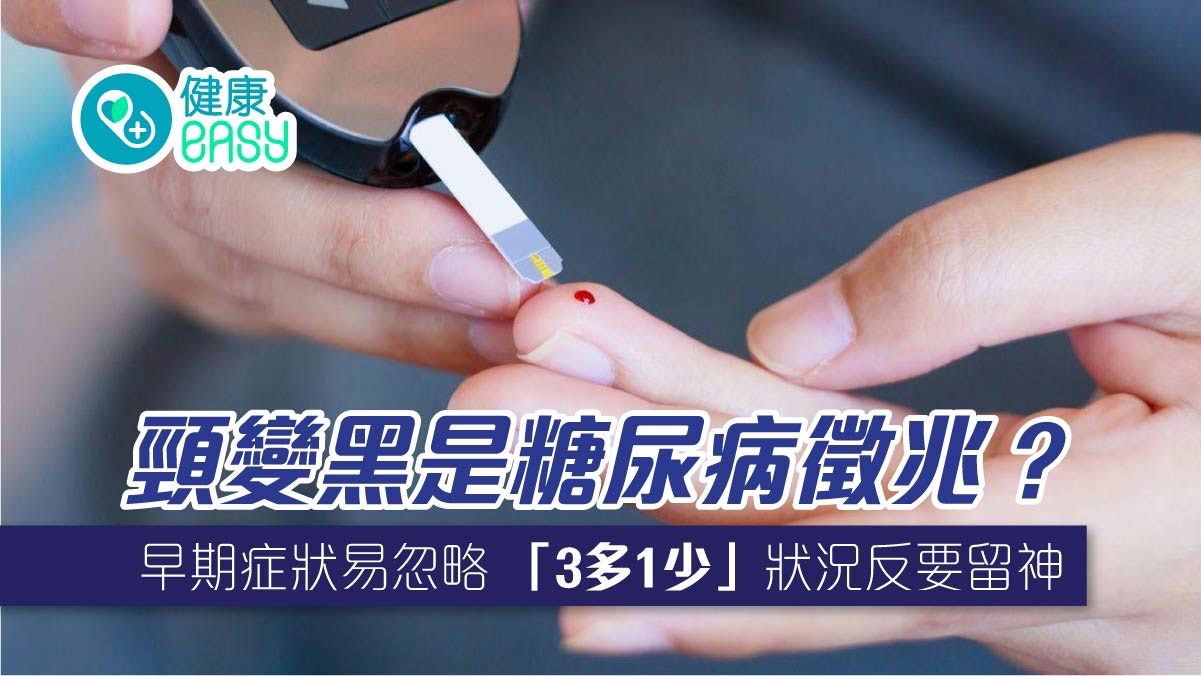 糖尿病|頸子變黑是徵兆?難從膚色判斷 「3多1少」狀況反要留神 糖尿病|頸子變黑是徵兆?難從膚色判斷 「3多1少」狀況反要留神