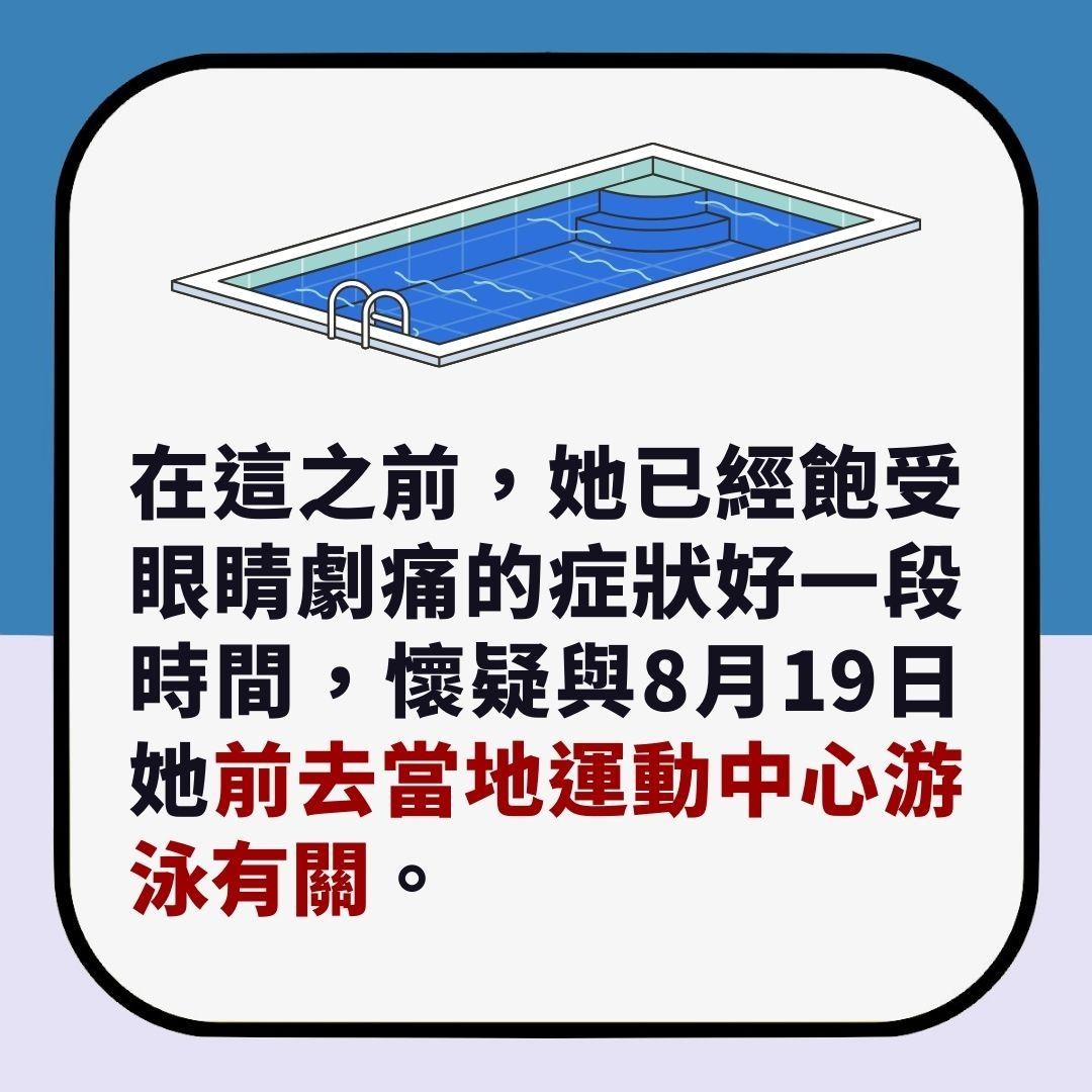 游泳後眼睛又痛又癢　女子10周後突然失明　竟是角膜遭食肉菌啃食（01製圖）