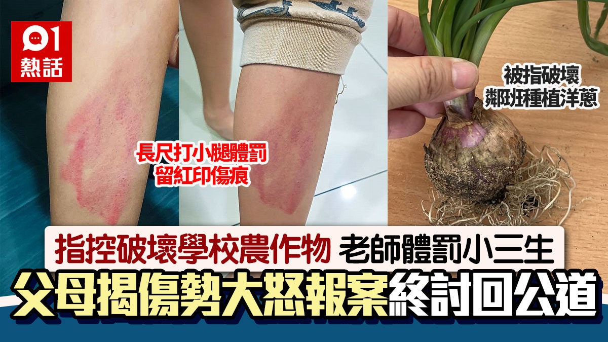 校田洋葱遭破壞 老師懷疑小三生搗蛋長尺打腳體罰 父母大怒報警 校田洋葱遭破壞 老師懷疑小三生搗蛋長尺打腳體罰 父母大怒報警