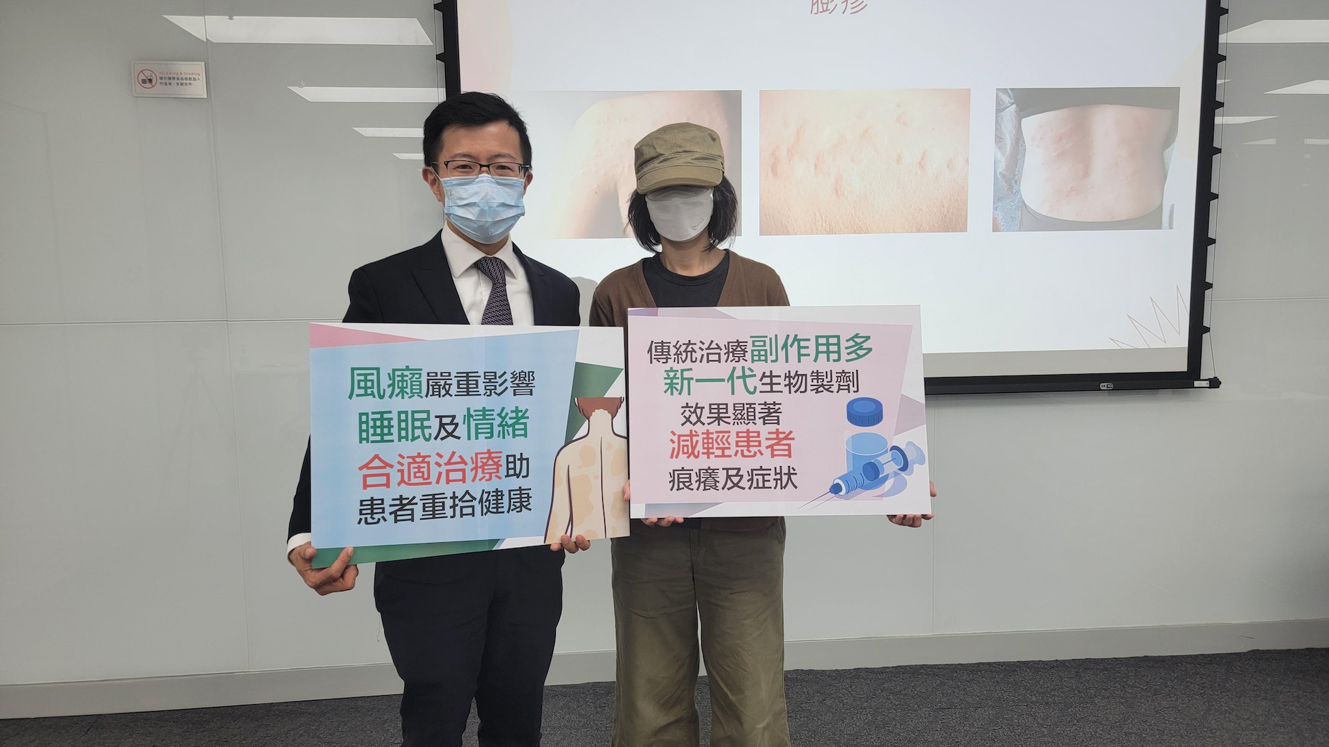 風癩反覆發作困生活 生物製劑可改善 風癩反覆發作困生活 生物製劑可改善