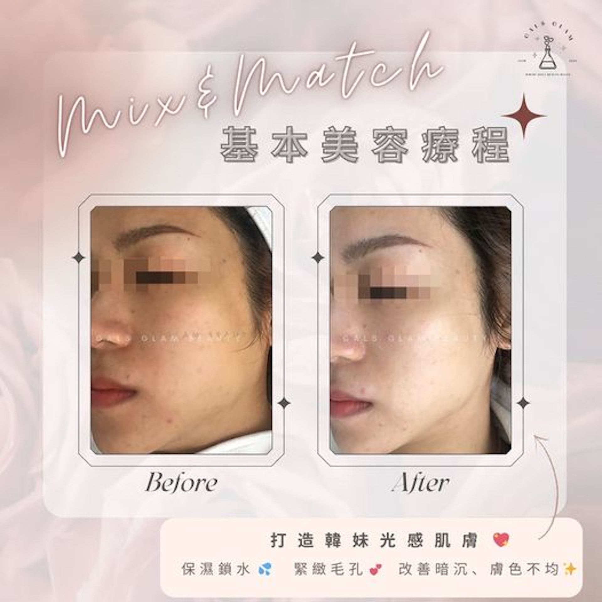 「galsglam.beauty」昔日帖文關於美容的療程。(IG圖片) 「galsglam.beauty」昔日帖文關於美容的療程。(IG圖片)