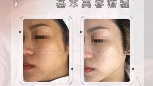 女悅醫美5顧客消脂注射後疑膿腫分枝桿菌 防護中心及警方調查 女悅醫美5顧客消脂注射後疑膿腫分枝桿菌 防護中心及警方調查
