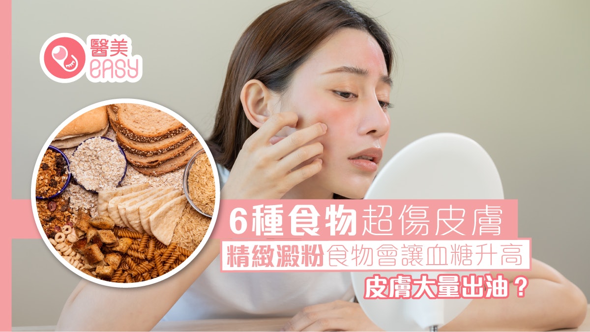 護膚陷阱|攝取精緻澱粉易衰老誘發暗瘡?6種食物超傷皮膚要避開 護膚陷阱|攝取精緻澱粉易衰老誘發暗瘡?6種食物超傷皮膚要避開