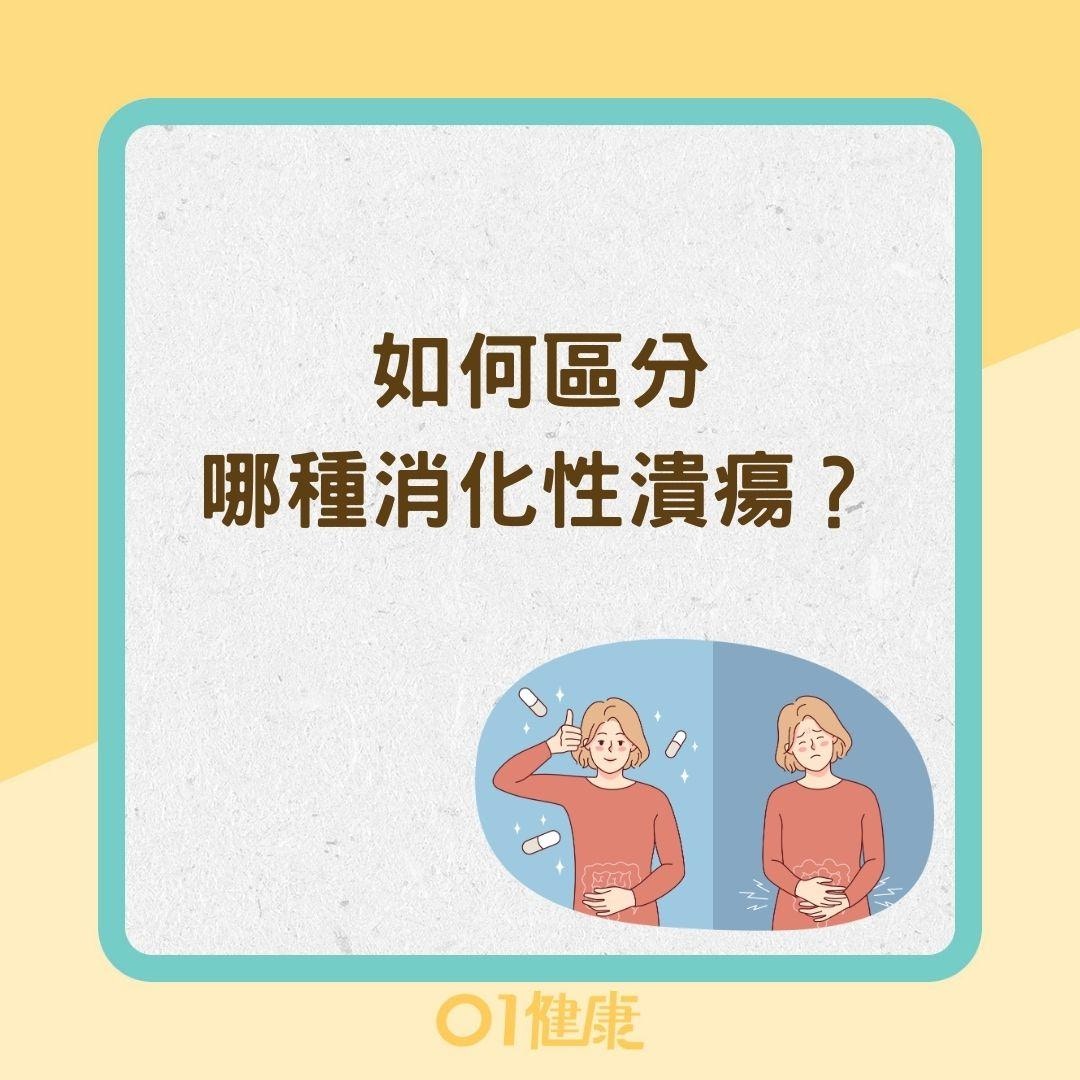 如何區分哪種消化性潰瘍？（01製圖）