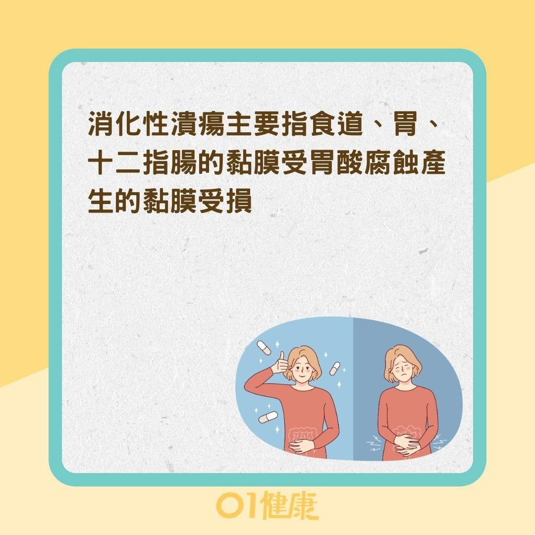 如何區分哪種消化性潰瘍？（01製圖）