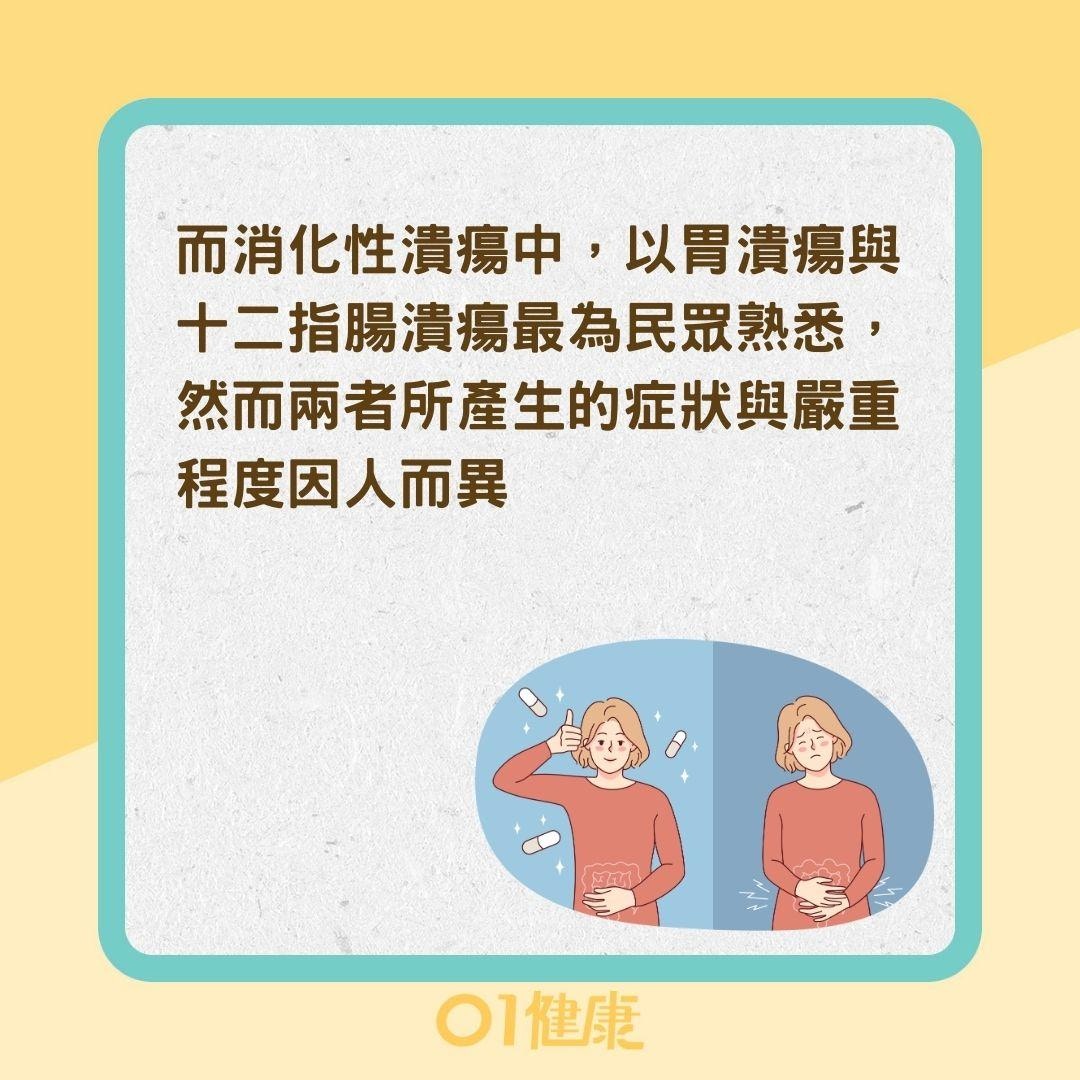 如何區分哪種消化性潰瘍？（01製圖）