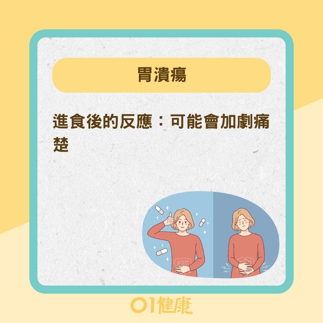 如何區分哪種消化性潰瘍？（01製圖）