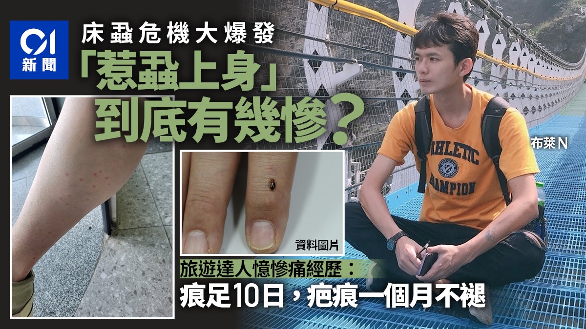 被床蝨咬有多慘?旅遊達人也受害 稱1個月還有疤 半夜會被癢醒 被床蝨咬有多慘?旅遊達人也受害 稱1個月還有疤 半夜會被癢醒