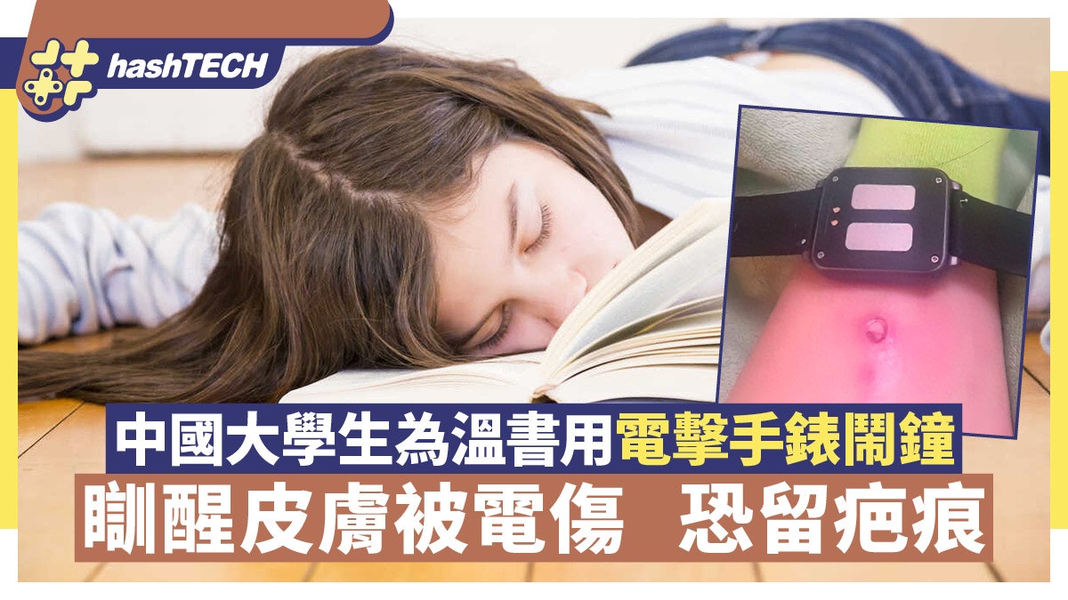 電擊手錶鬧鐘危險又無用|皮膚電穿窿留痕跡!中國學生仍堅持使用 電擊手錶鬧鐘危險又無用|皮膚電穿窿留痕跡!中國學生仍堅持使用