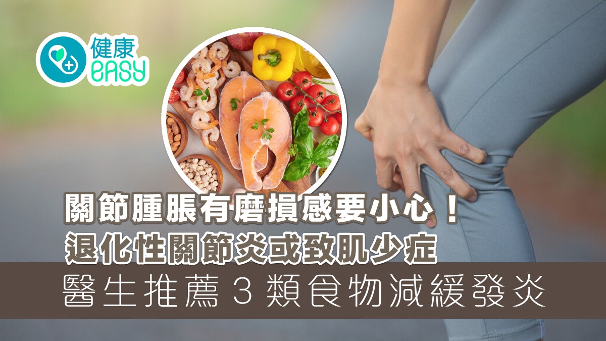 退化性關節炎|關節腫脹有磨損感要小心!3食物減緩發炎修復軟骨 退化性關節炎|關節腫脹有磨損感要小心!3食物減緩發炎修復軟骨