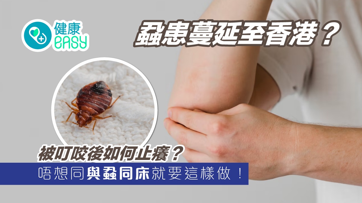 床蝨|床蝨叮咬後奇癢無比!2物可止癢、預防臭蟲跟回家要這樣做 床蝨|床蝨叮咬後奇癢無比!2物可止癢、預防臭蟲跟回家要這樣做