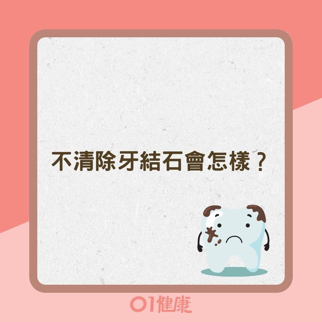 不清除牙結石會怎樣？（01製圖）