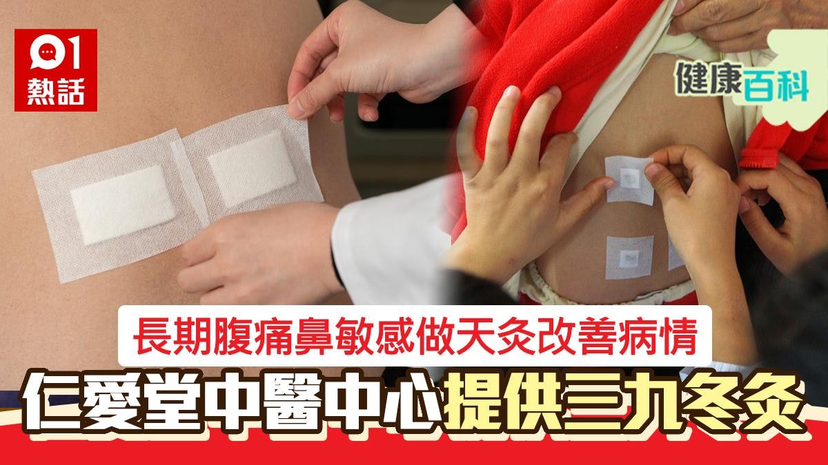 長期腹痛鼻敏感做天灸改善病情 仁愛堂中醫提供三九冬灸|附詳情 長期腹痛鼻敏感做天灸改善病情 仁愛堂中醫提供三九冬灸|附詳情