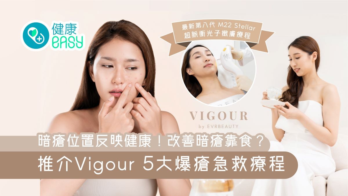 暗瘡懶人包|8位置知便秘或胃火盛?排毒5穴位+5色食物忌洗面太多 暗瘡懶人包|8位置知便秘或胃火盛?排毒5穴位+5色食物忌洗面太多