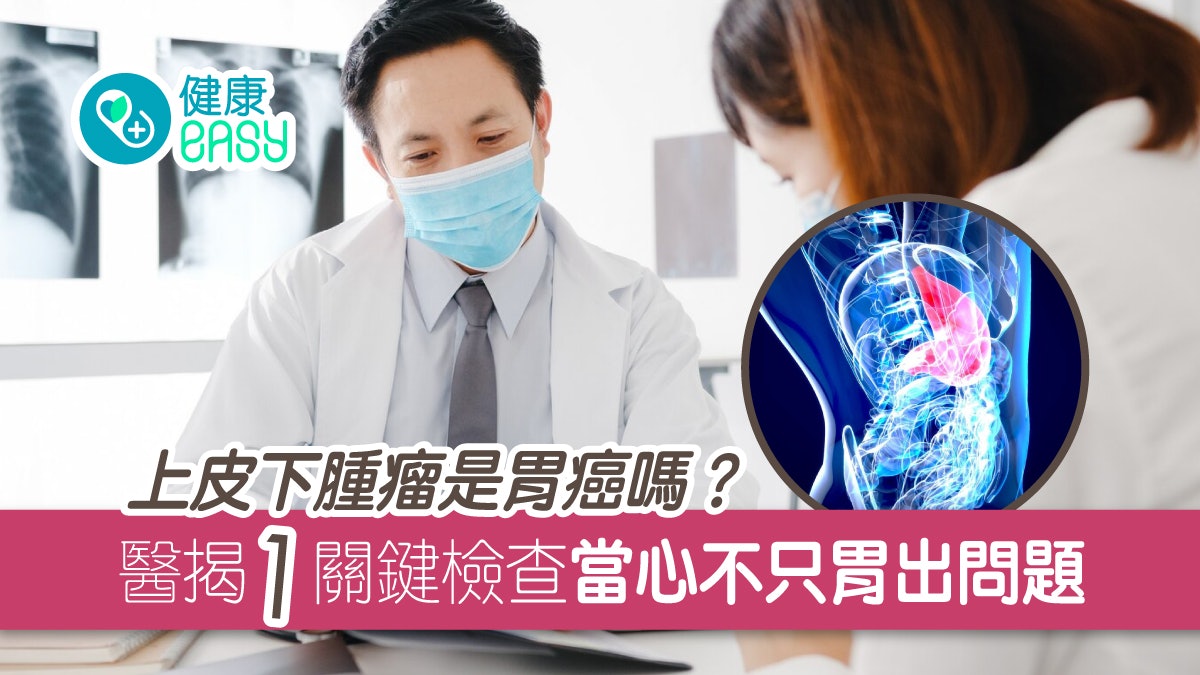 腸胃健康|上皮下腫瘤是胃癌嗎?醫揭1關鍵檢查當心不只胃出問題 腸胃健康|上皮下腫瘤是胃癌嗎?醫揭1關鍵檢查當心不只胃出問題