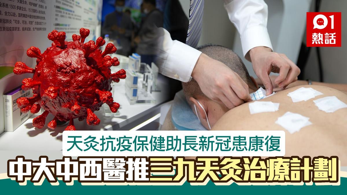 天灸抗疫保健助長新冠康復 中大中西醫三九天灸治療計劃|附詳情 天灸抗疫保健助長新冠康復 中大中西醫三九天灸治療計劃|附詳情