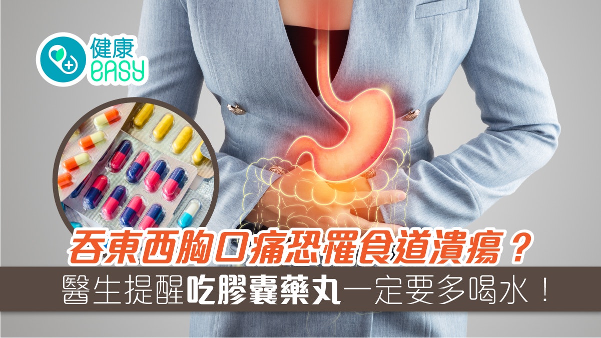 吞東西胸口痛恐罹食道潰瘍發炎?醫生提醒吃膠囊藥丸一定要多喝水 吞東西胸口痛恐罹食道潰瘍發炎?醫生提醒吃膠囊藥丸一定要多喝水