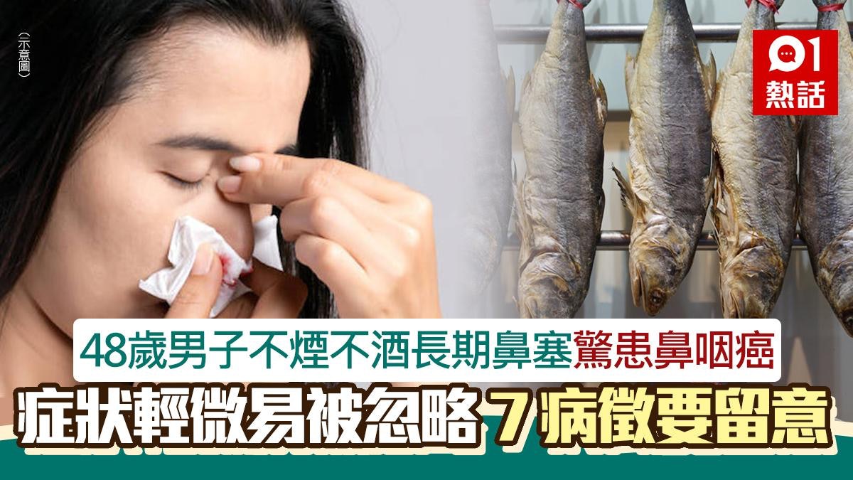 男子不煙不酒長期鼻塞 驗出鼻咽癌第4期 醫生警告注意7輕微症狀 男子不煙不酒長期鼻塞 驗出鼻咽癌第4期 醫生警告注意7輕微症狀