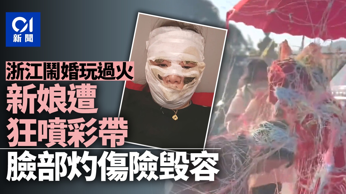 鬧婚習俗玩過頭　向新娘狂噴泡沫、撒彩帶　造成臉部灼傷險毀容