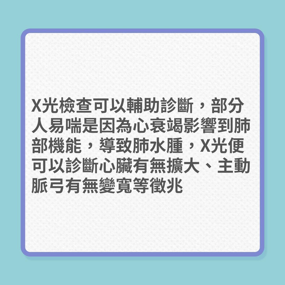 心臟健康｜8種見心臟檢查方法（01製圖）