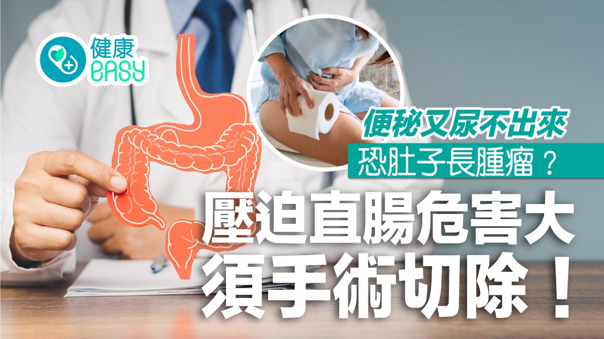 便秘又尿不出來恐肚子長軟組織肉瘤?壓迫直腸危害大須手術切除 便秘又尿不出來恐肚子長軟組織肉瘤?壓迫直腸危害大須手術切除