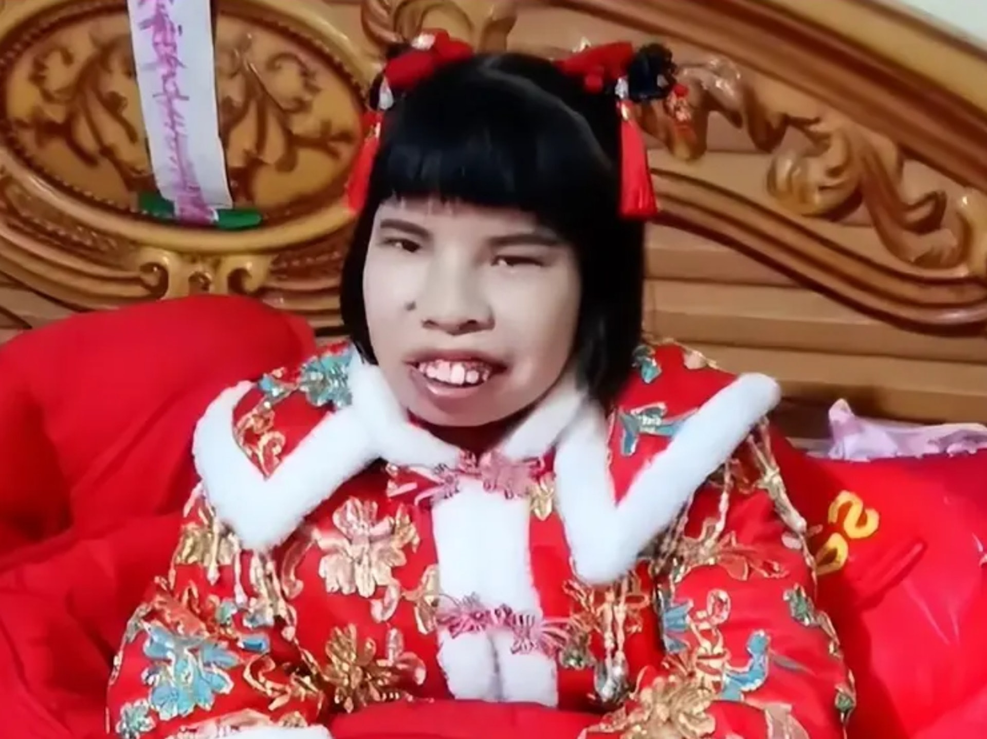 貴州一名新郎在舉辦婚禮時,整場擺著一張臭臉,且全程都沒有與一旁的妻子交流。原來因為妻子不但不是他自己挑的,外貌更與他的理想型相差甚遠。(網易圖片) 貴州一名新郎在舉辦婚禮時,整場擺著一張臭臉,且全程都沒有與一旁的妻子交流。原來因為妻子不但不是他自己挑的,外貌更與他的理想型相差甚遠。(網易圖片)