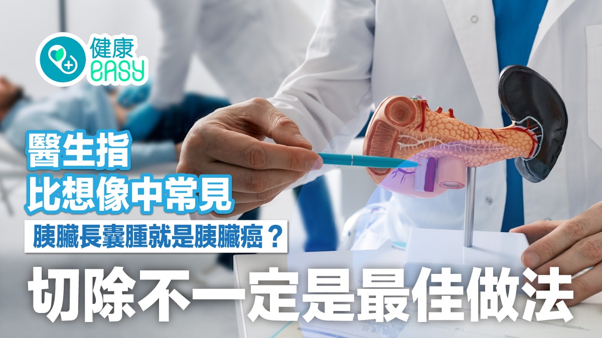 胰臟健康|胰臟長囊腫就是胰臟癌?醫揭比想像中常見建議詳細檢查 胰臟健康|胰臟長囊腫就是胰臟癌?醫揭比想像中常見建議詳細檢查