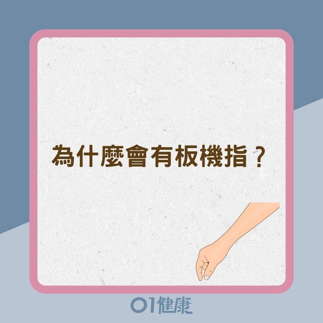 為什麼會有板機指？（01製圖）