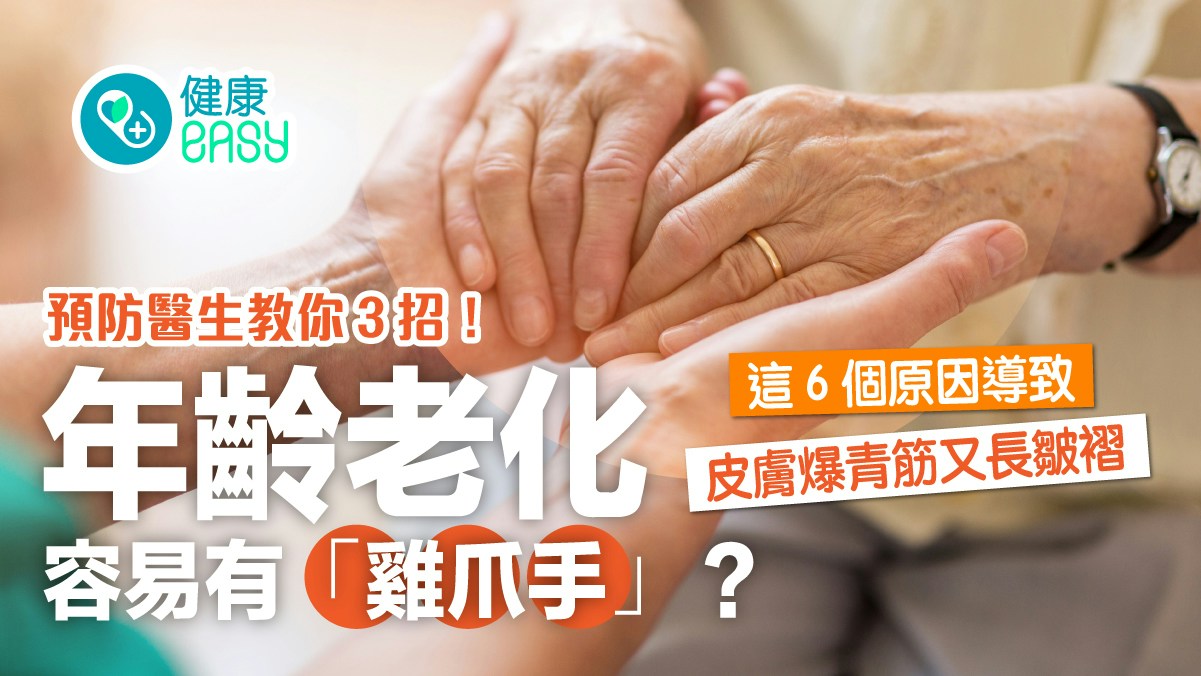 護膚｜年齡老化容易有「雞爪手」？6大原因導致皮膚爆青筋長皺褶