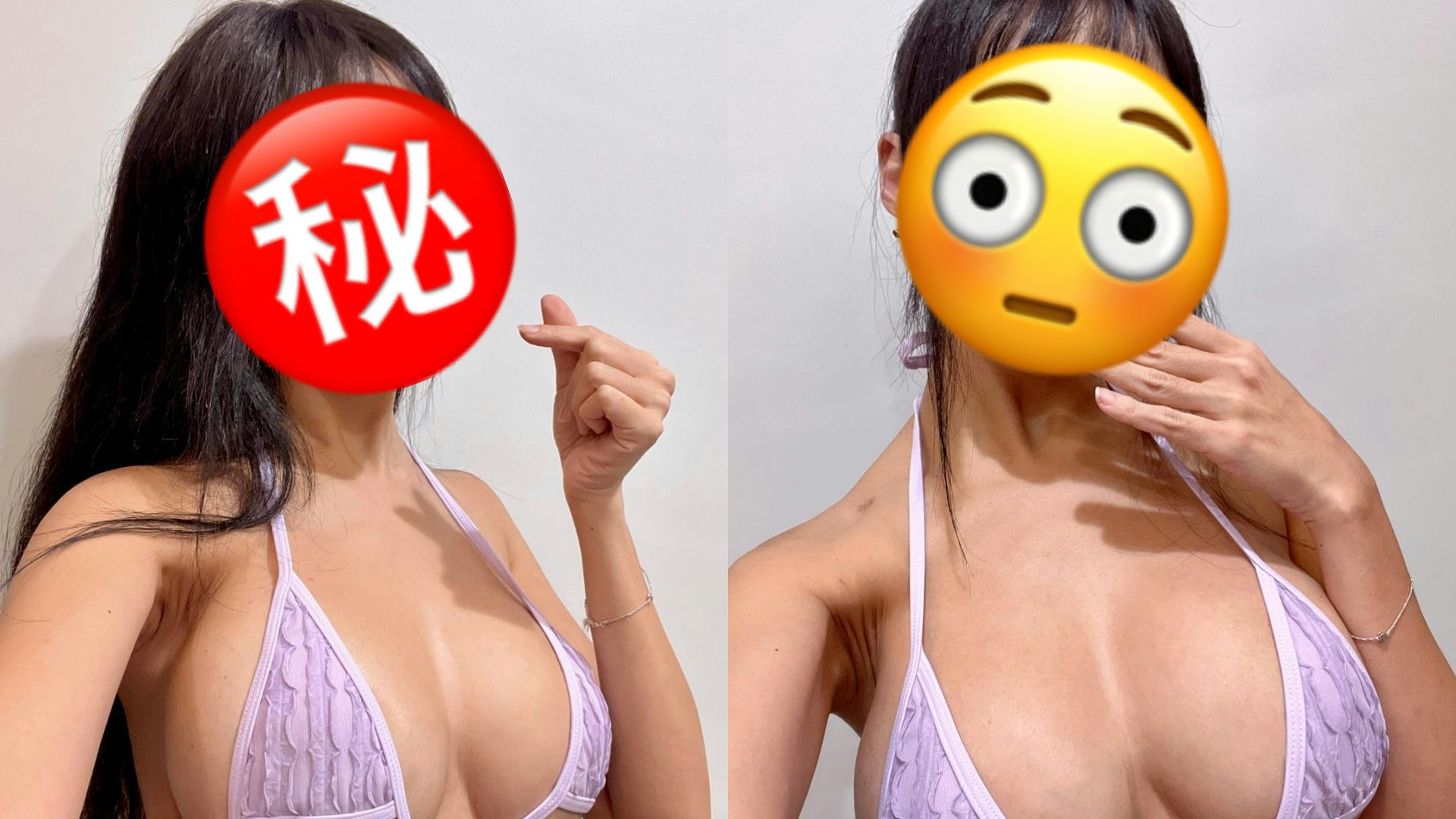 39歲女星昔日被嘲「胸部小」三度隆乳　曾變石頭奶：硬掉變成一塊