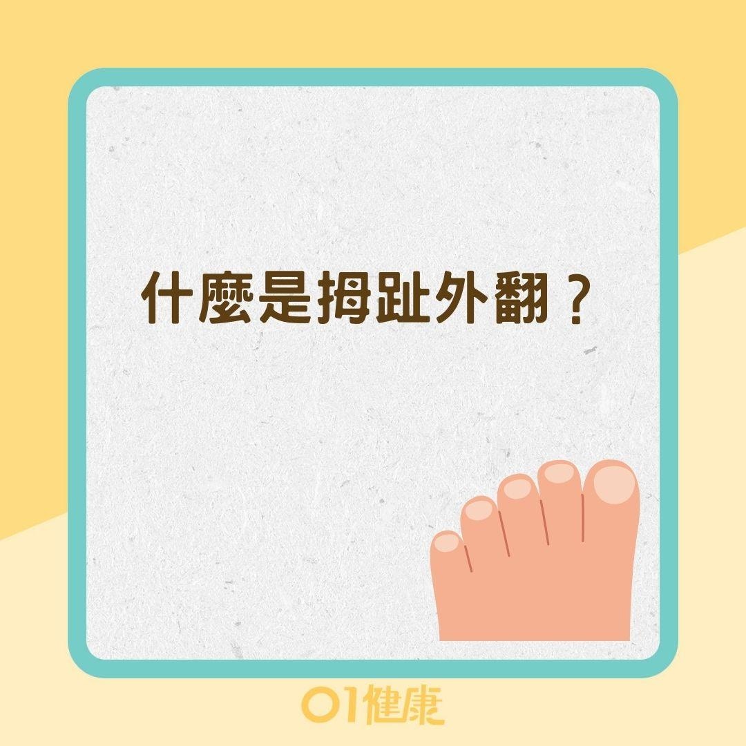什麼是拇趾外翻？（01製圖）