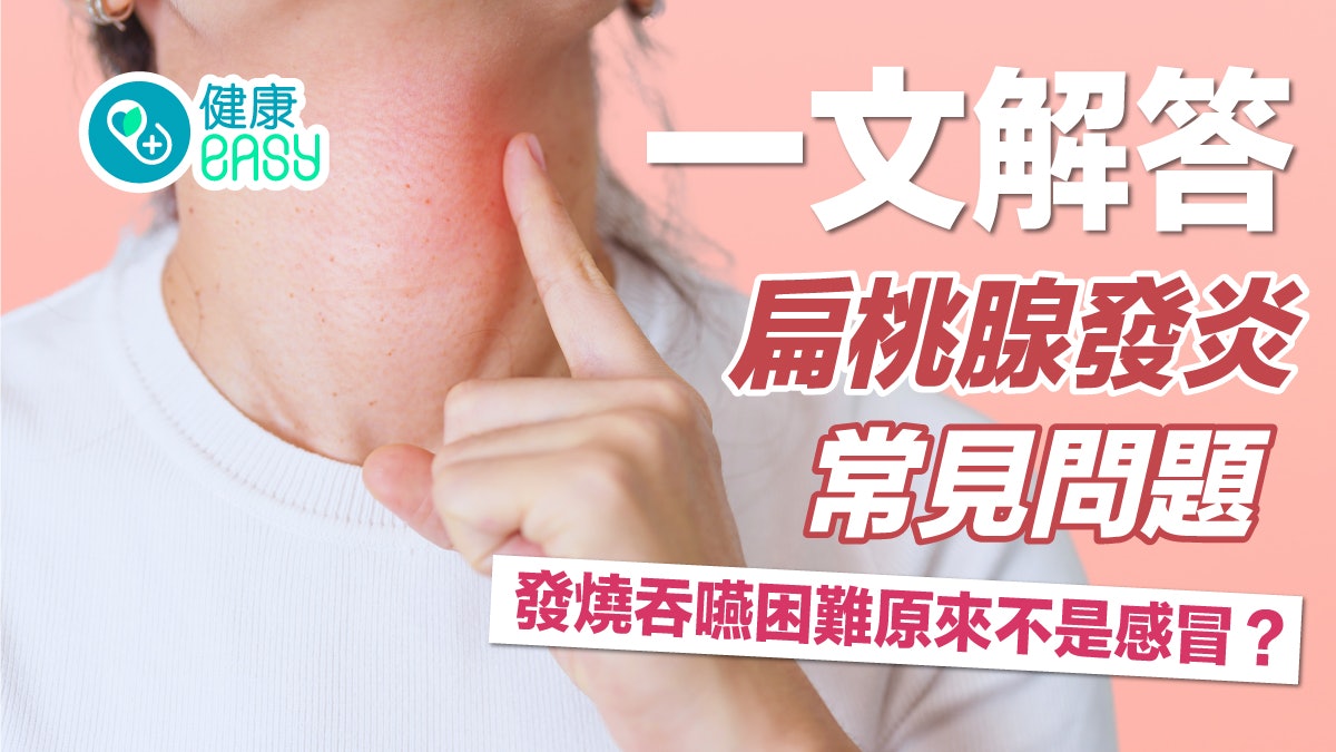 喉嚨痛|發燒吞嚥困難原來不是感冒?一文解答扁桃腺發炎常見問題 喉嚨痛|發燒吞嚥困難原來不是感冒?一文解答扁桃腺發炎常見問題