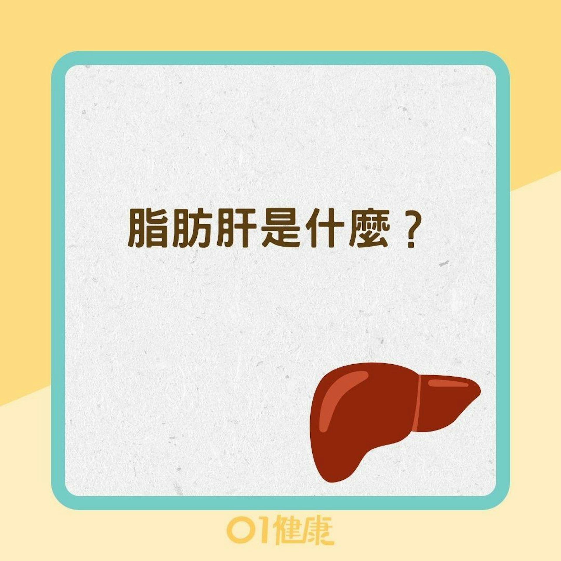 脂肪肝是什麼? (01製圖) 脂肪肝是什麼? (01製圖)