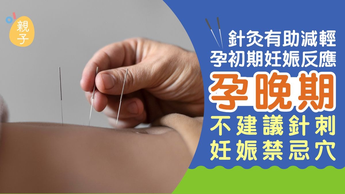 懷孕針灸有助減輕孕初期妊娠反應 孕晚期不建議針刺妊娠禁忌穴