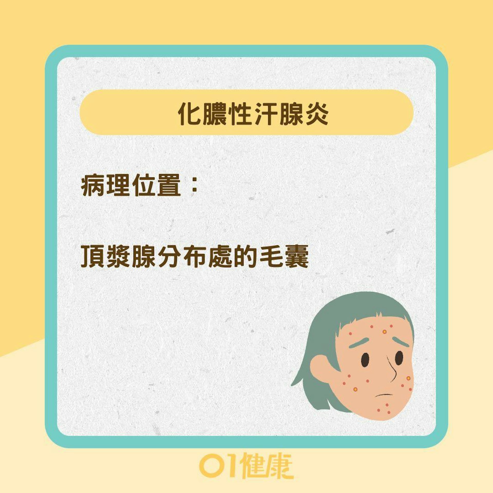化膿性汗腺炎與青春痘差異 (01製圖) 化膿性汗腺炎與青春痘差異 (01製圖)