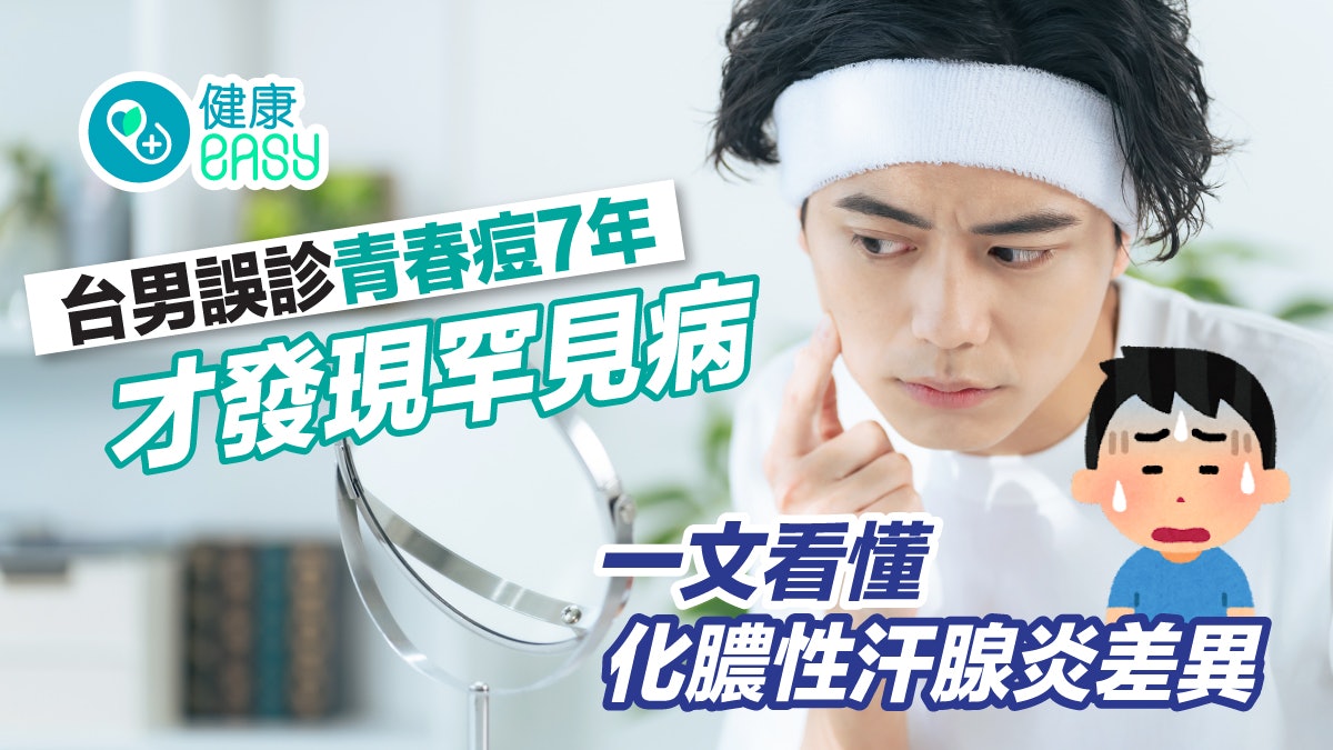 台男誤診青春痘7年才確診罕見病!一文看清化膿性汗腺炎暗瘡差異 台男誤診青春痘7年才確診罕見病!一文看清化膿性汗腺炎暗瘡差異